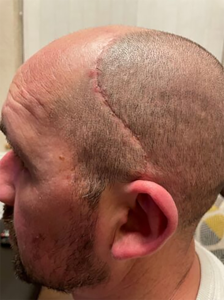 Steven Tyson injured when wall collapsed Steven Tyson injured when wall collapsed on him